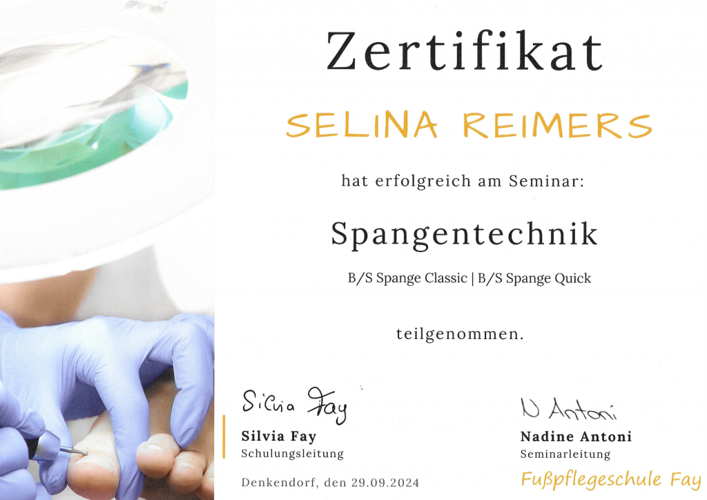 Spangentechnik